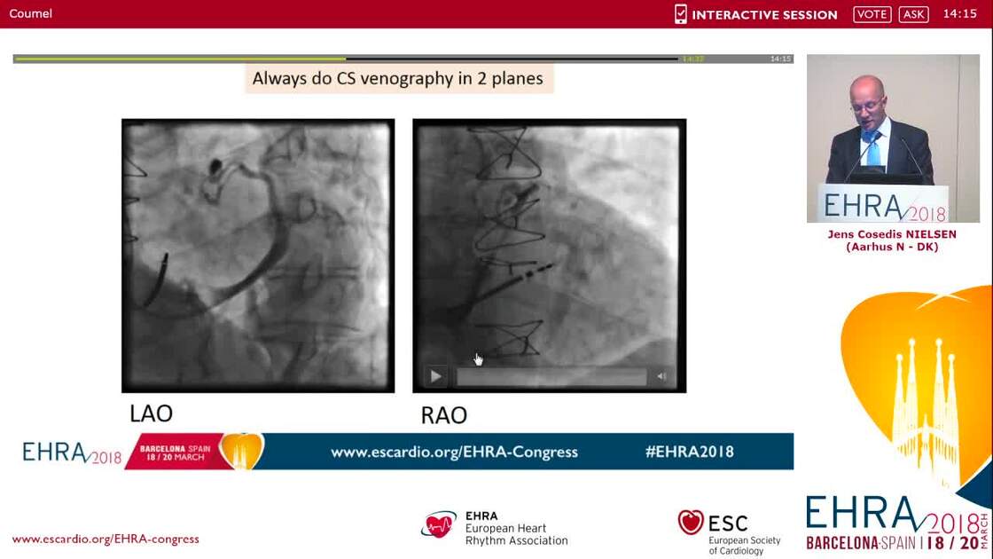 ESC 365 Anatomy For The CRT Implanter