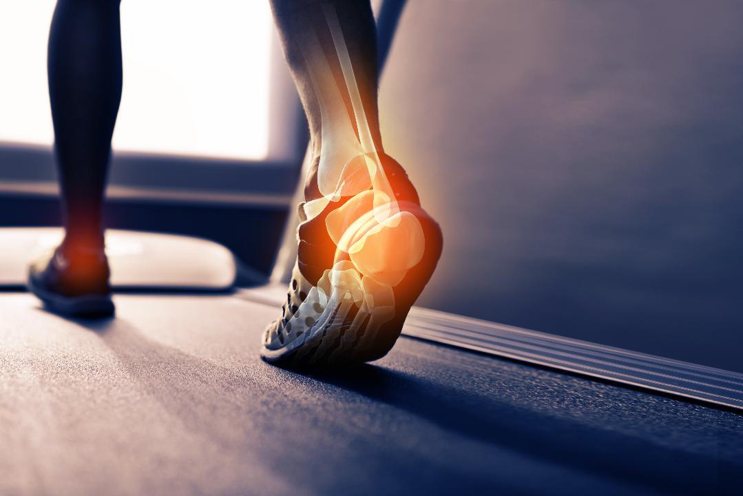 Does Psoriatic Arthritis Prevent Exercise?