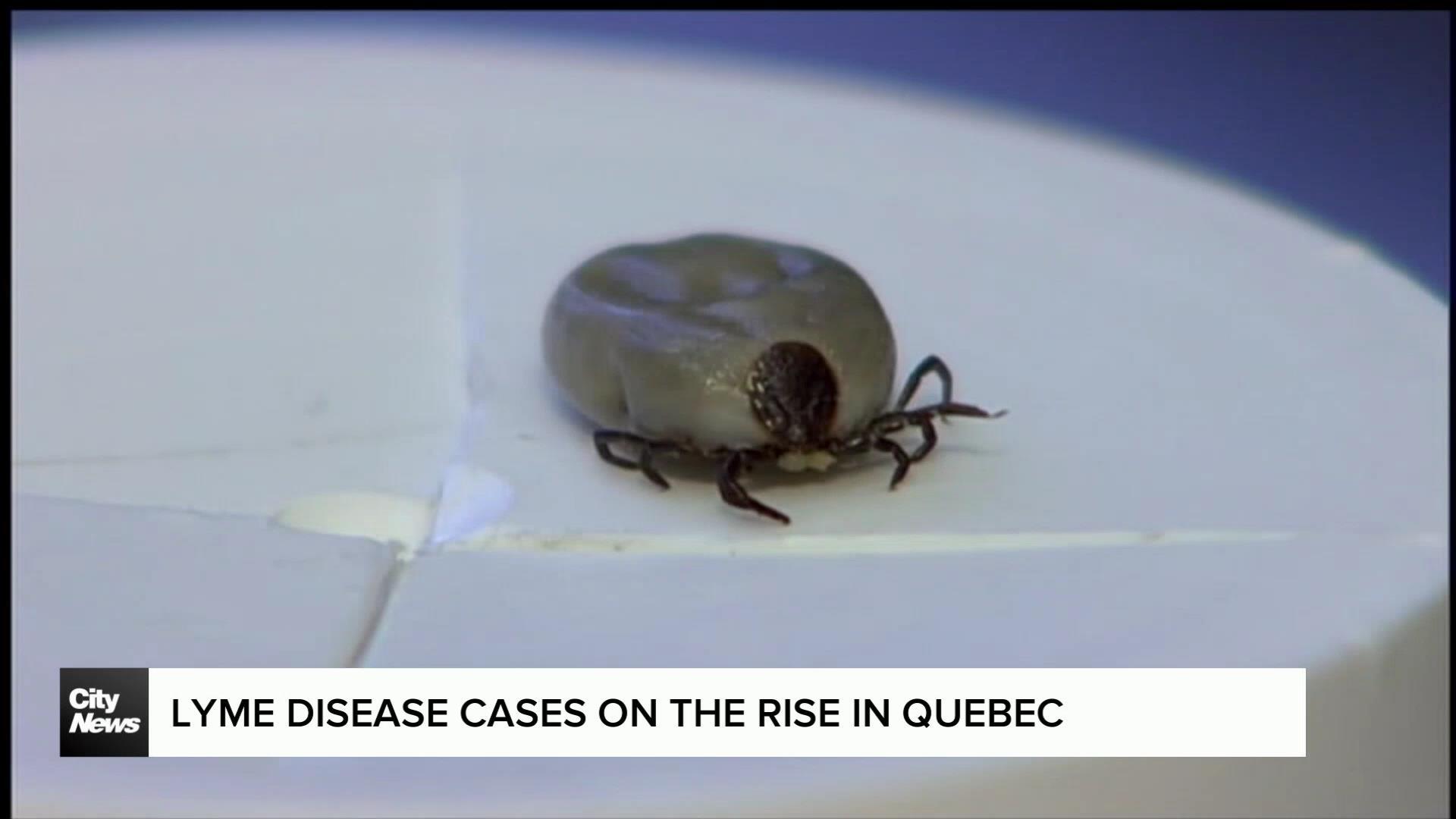 Lyme Disease Cases On The Rise In Quebec