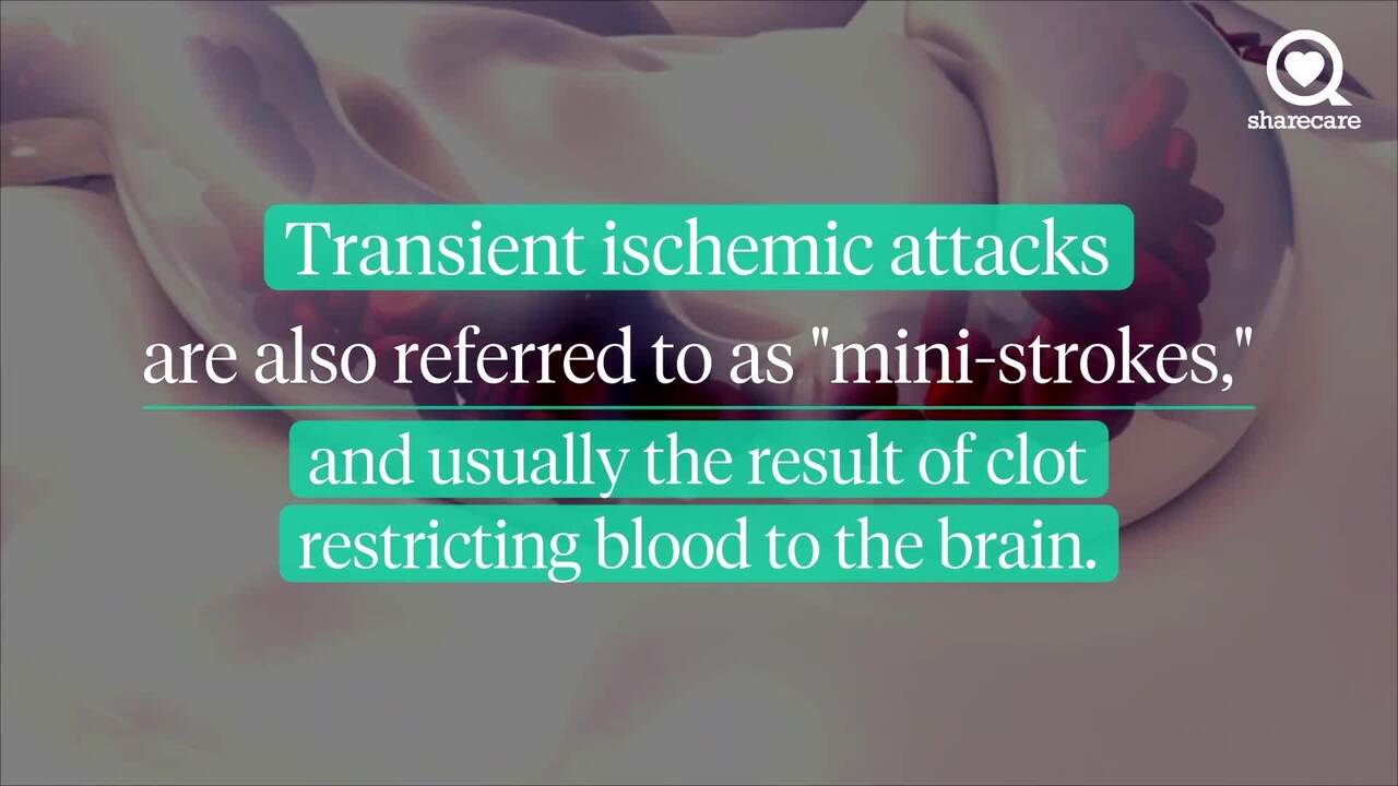 Younger people are having strokes more often