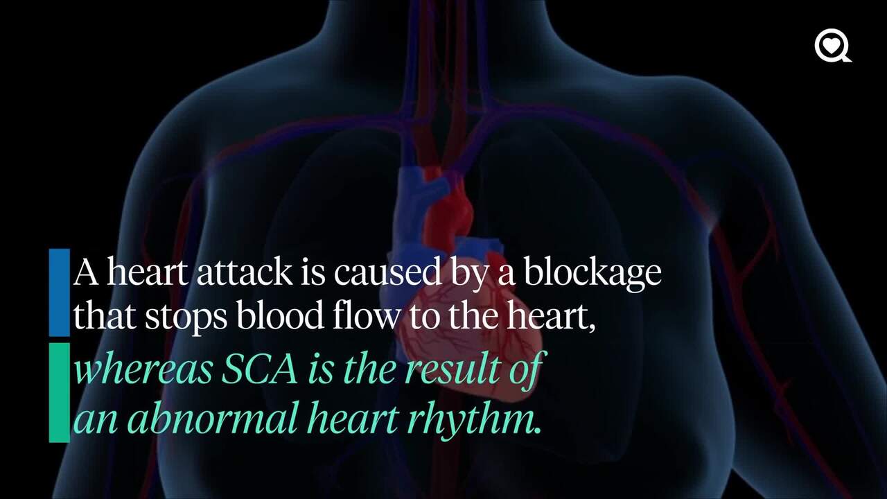 Bronny James, 18-year-old son of LeBron James, suffers cardiac arrest during workout