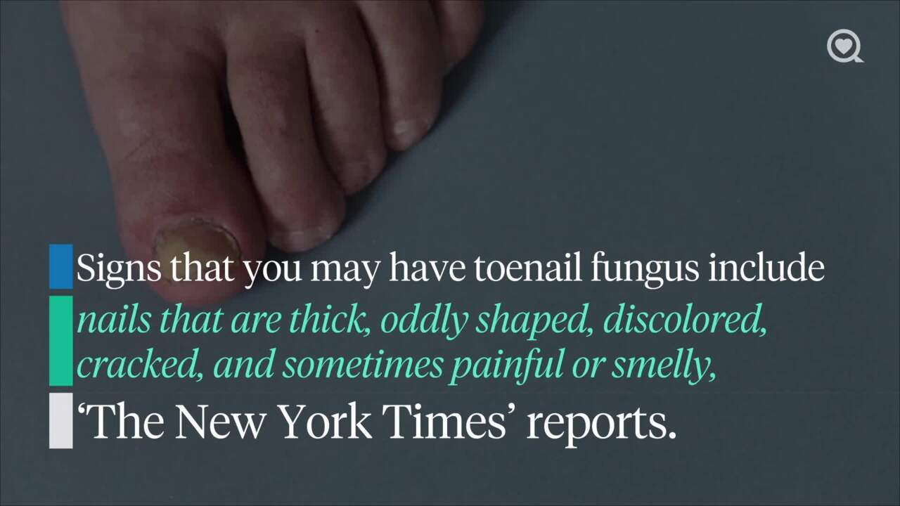 How to get rid of toenail fungus