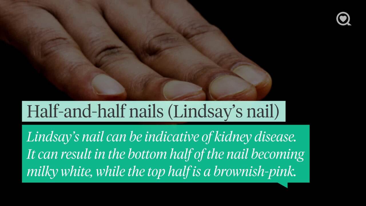 5 tips for healthy nails