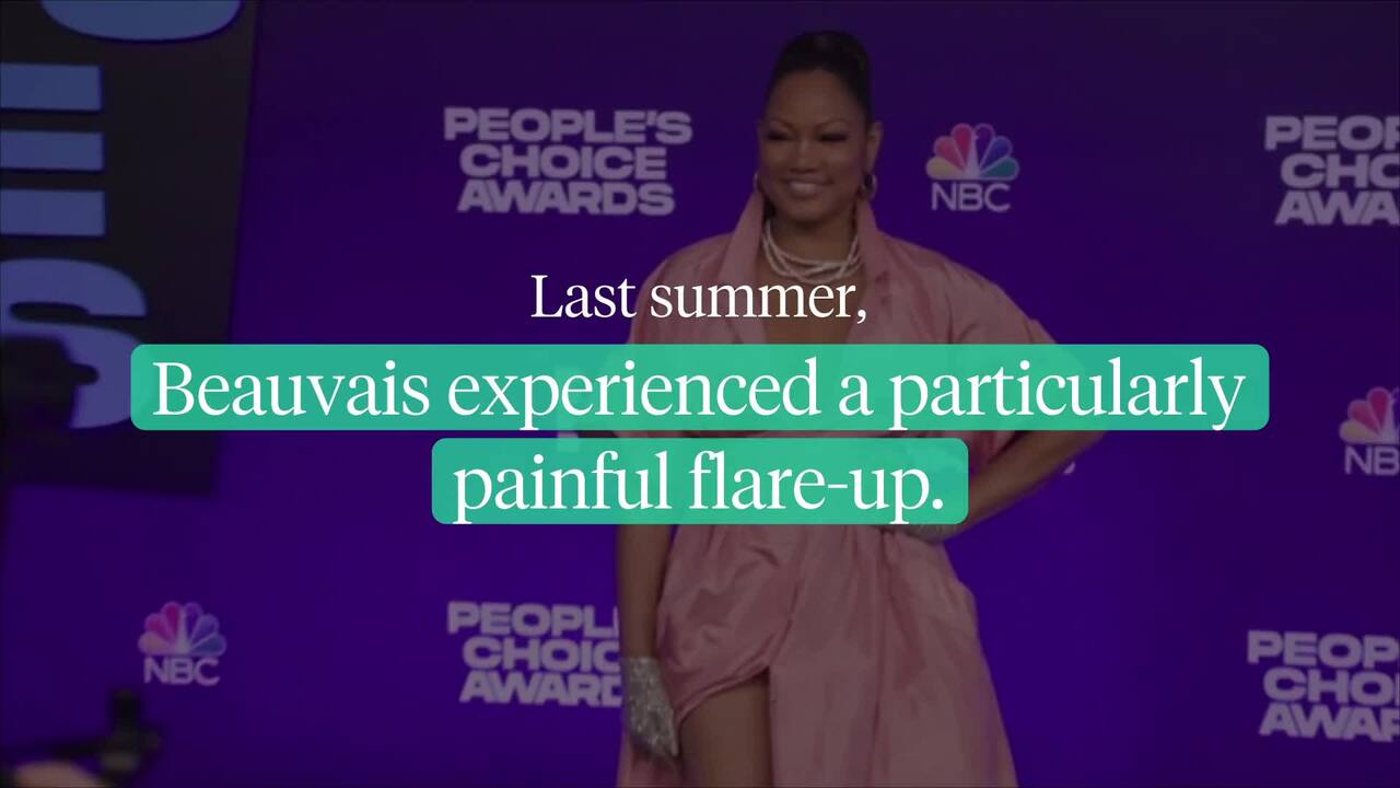 Garcelle Beauvais opens up about her battle with eczema