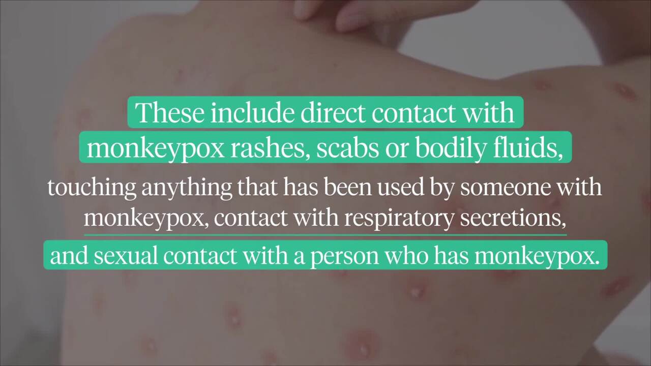 What you need to know about monkeypox: spread, vaccination and treatment