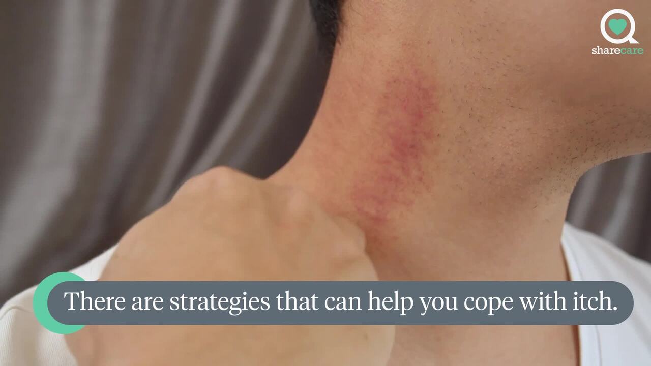 Chronic HIVes: 3 ways to cope with itching