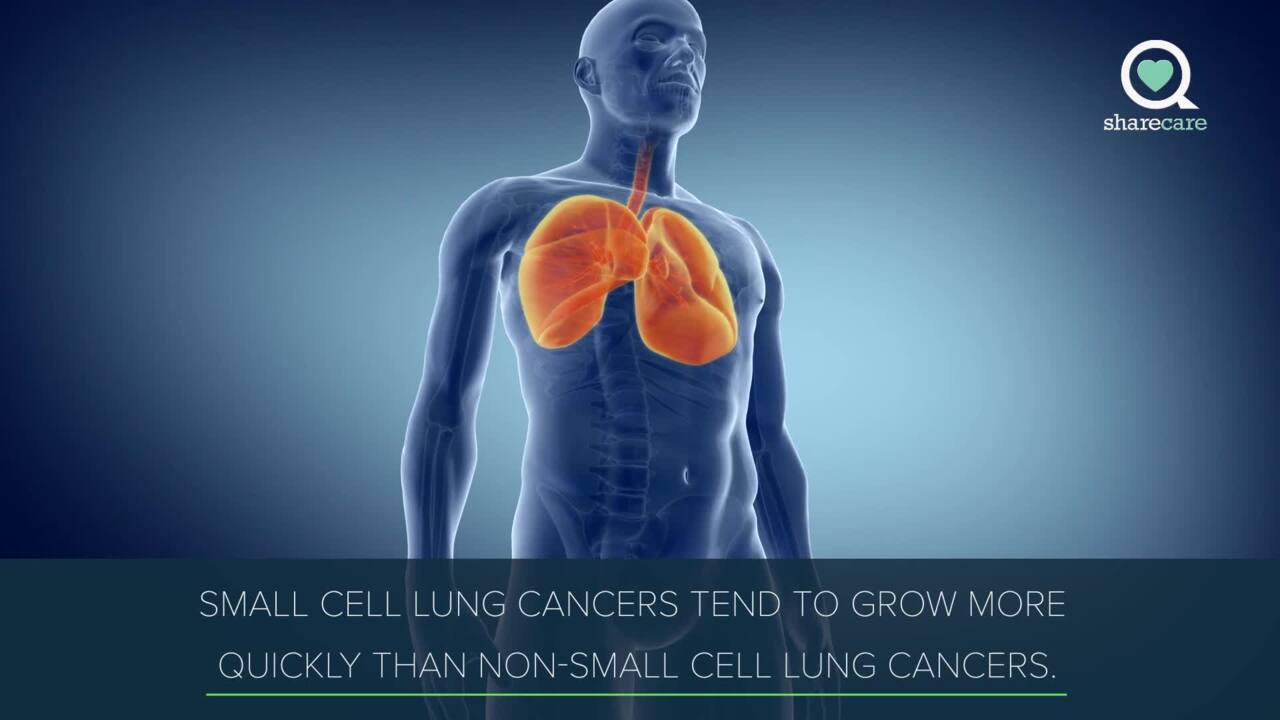 What is extensive stage small cell lung cancer?