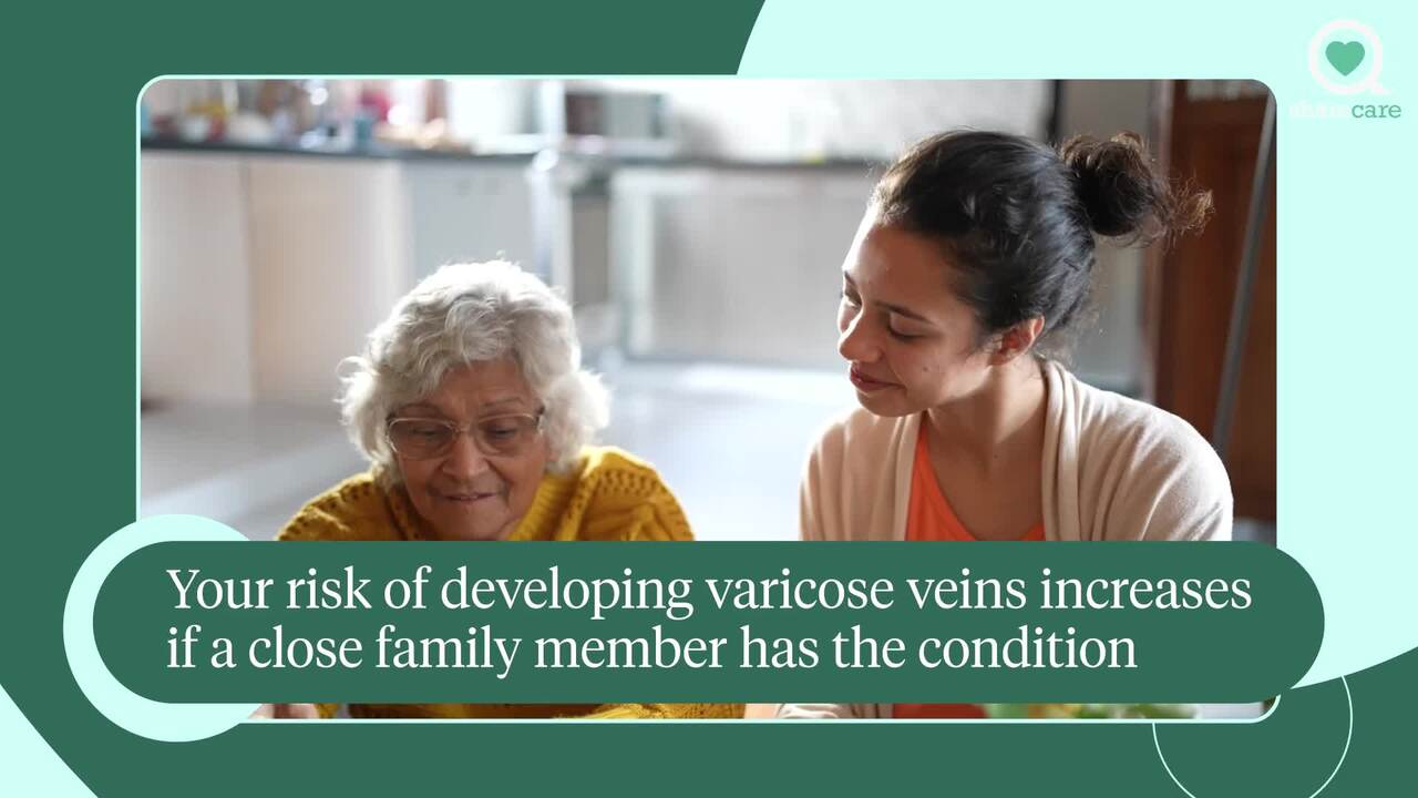 How can I prevent varicose veins and spider veins?