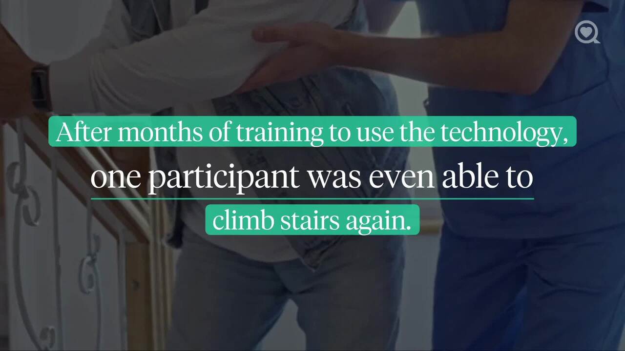 Spinal cord stimulation study helps paralyzed people walk again