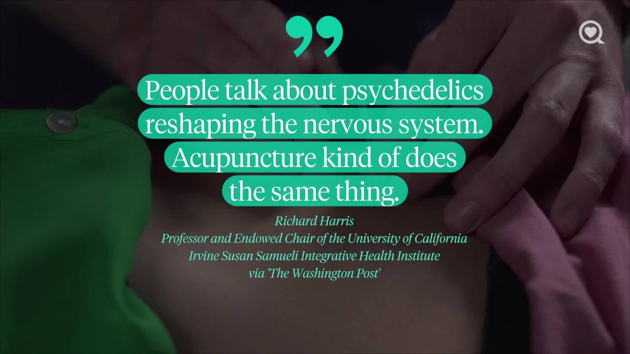 How acupuncture can be effective in treating chronic pain