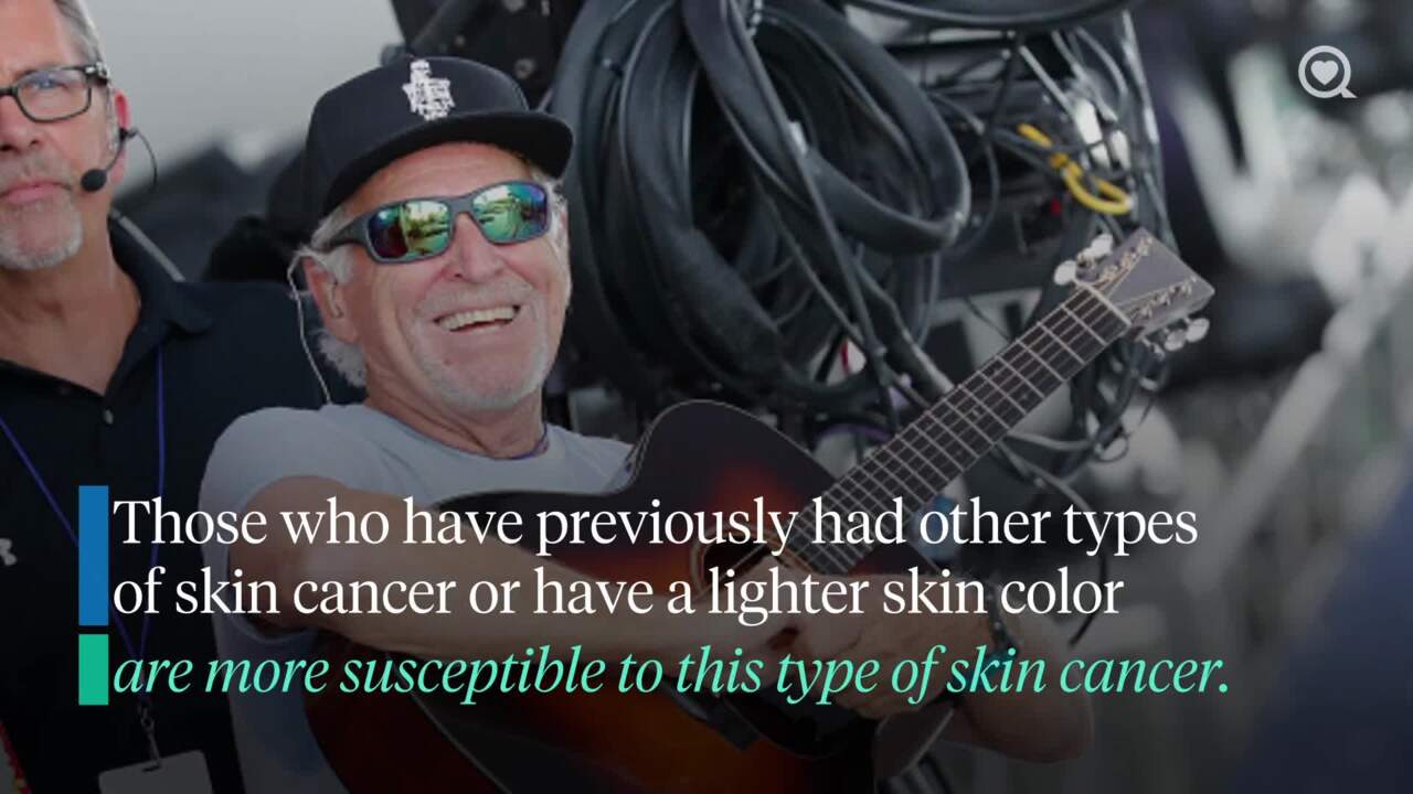 Jimmy Buffett dies from Merkel cell carcinoma: what you should know about the disease