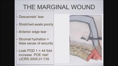 VIDEO: Key strategies to prevent postoperative endophthalmitis