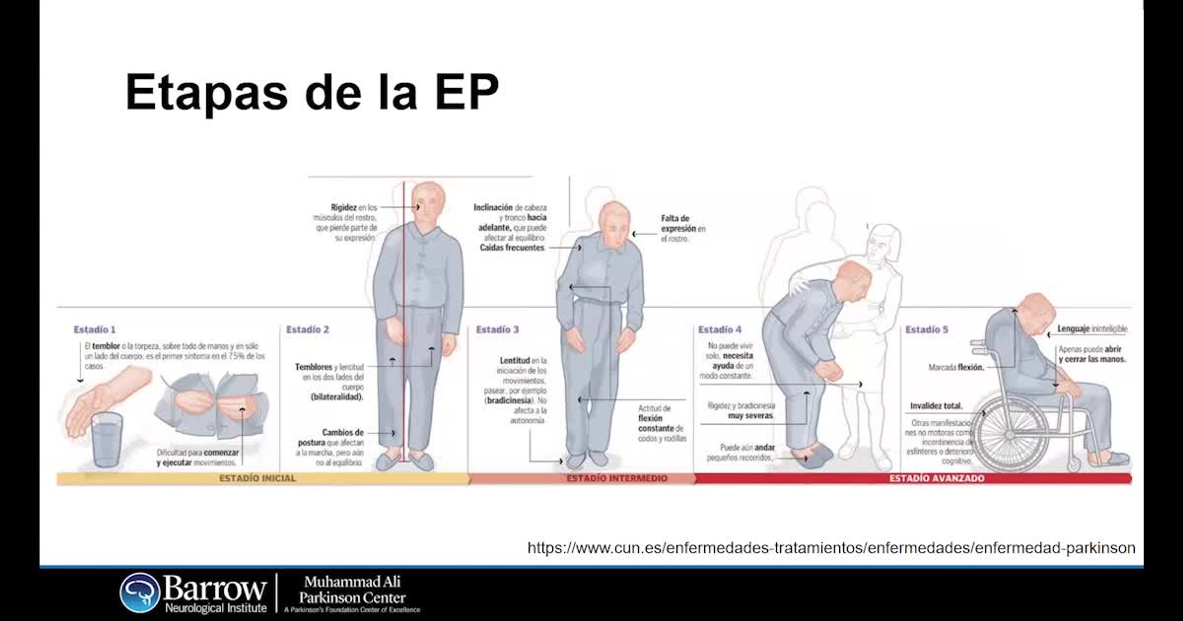 El Parkinson y sus Generalidades