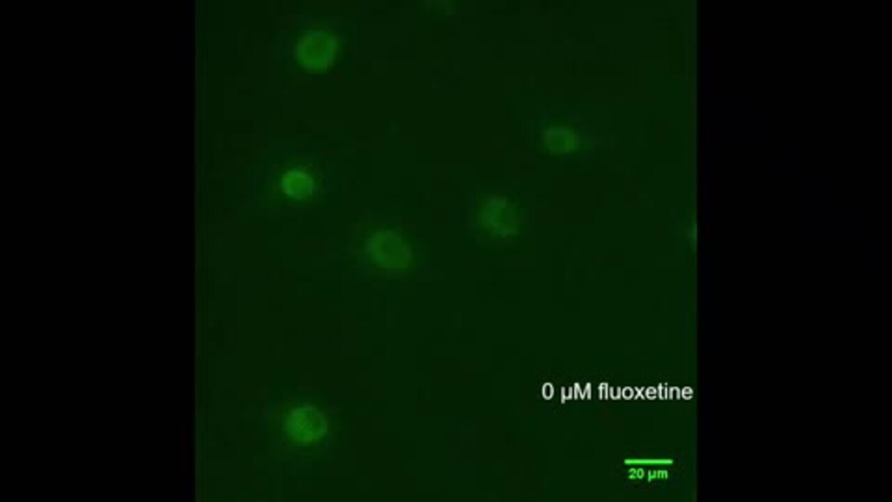 cagrilintide dosage Coadministered Cagrilintide and Semaglutide in Adults with Overweight or  Obesity