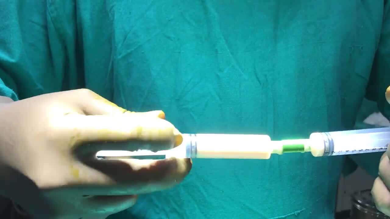 Penile Enlargement using Fat Grafting Video RealSelf