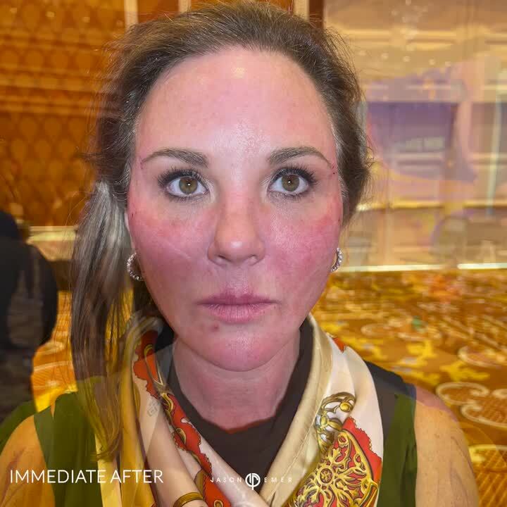 ?Vivacious Vertical Enhance? Video RealSelf