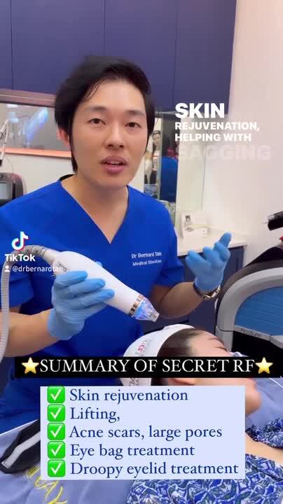 SecretRF RF Microneedling - Video - RealSelf