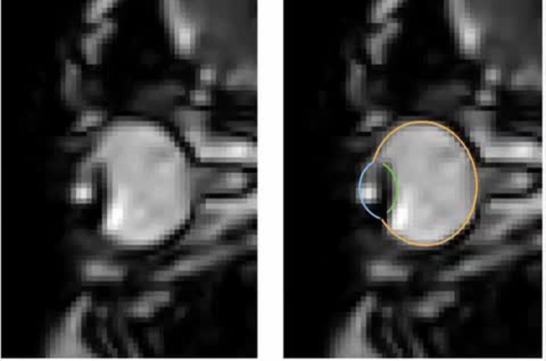 PDF) Diurnal oscillations of MRI metrics in the brains of male participants