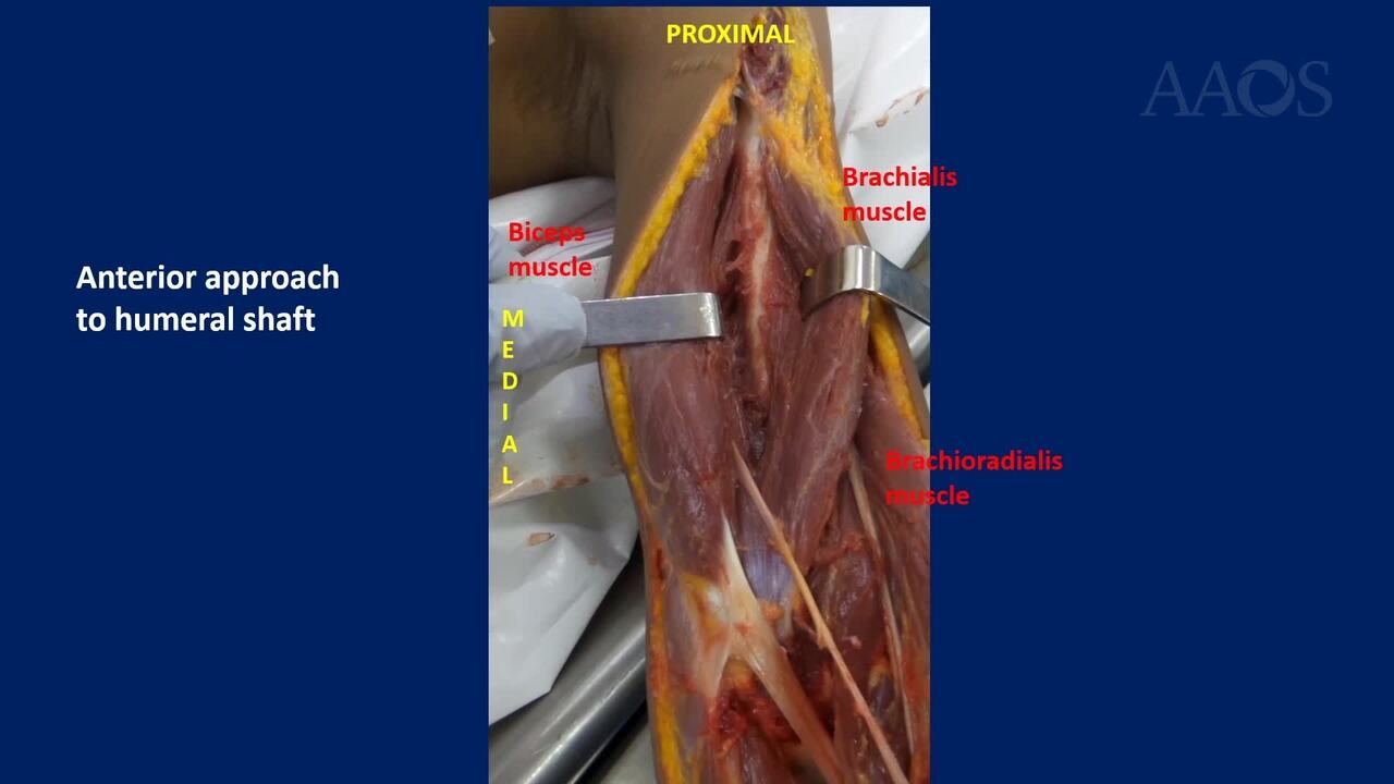 Video Details, image size:1280x720