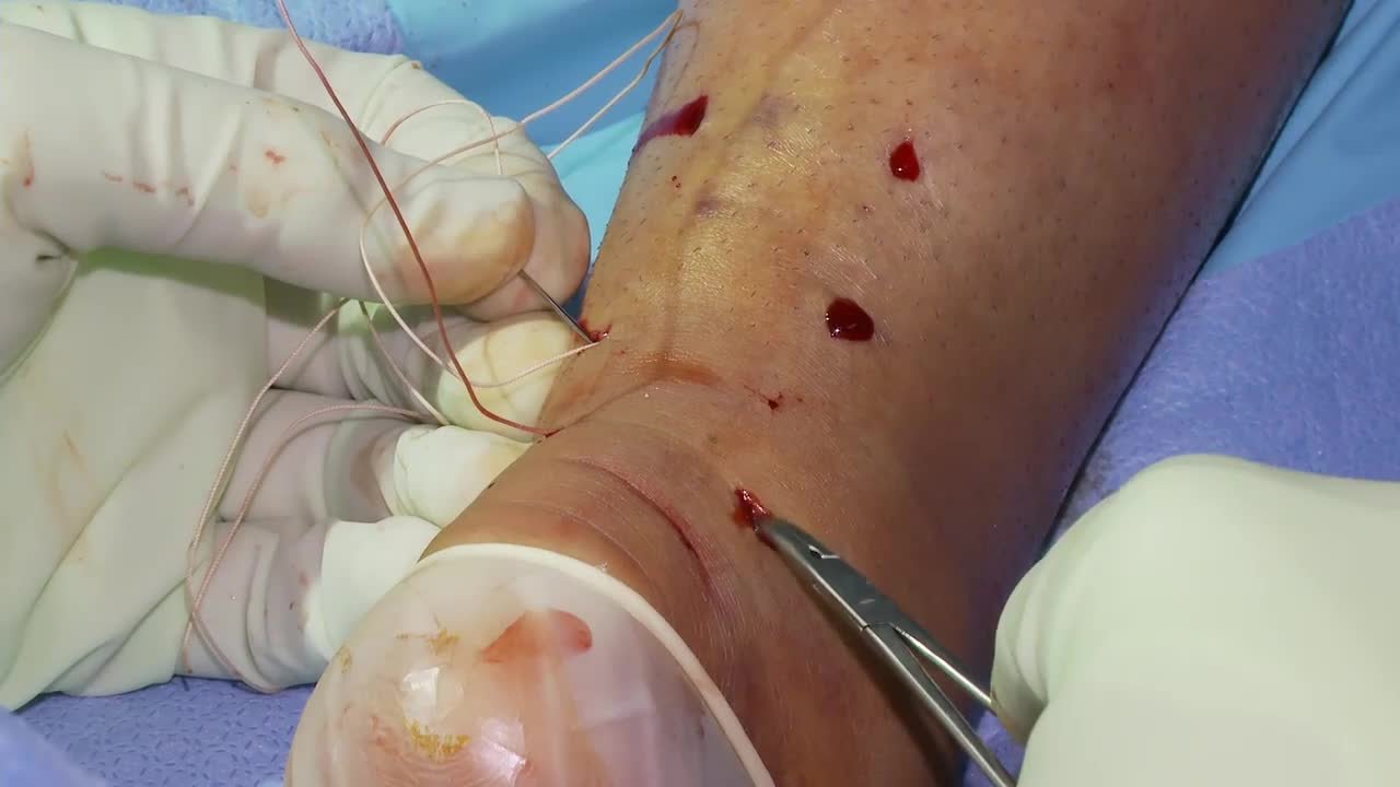 Video Details
