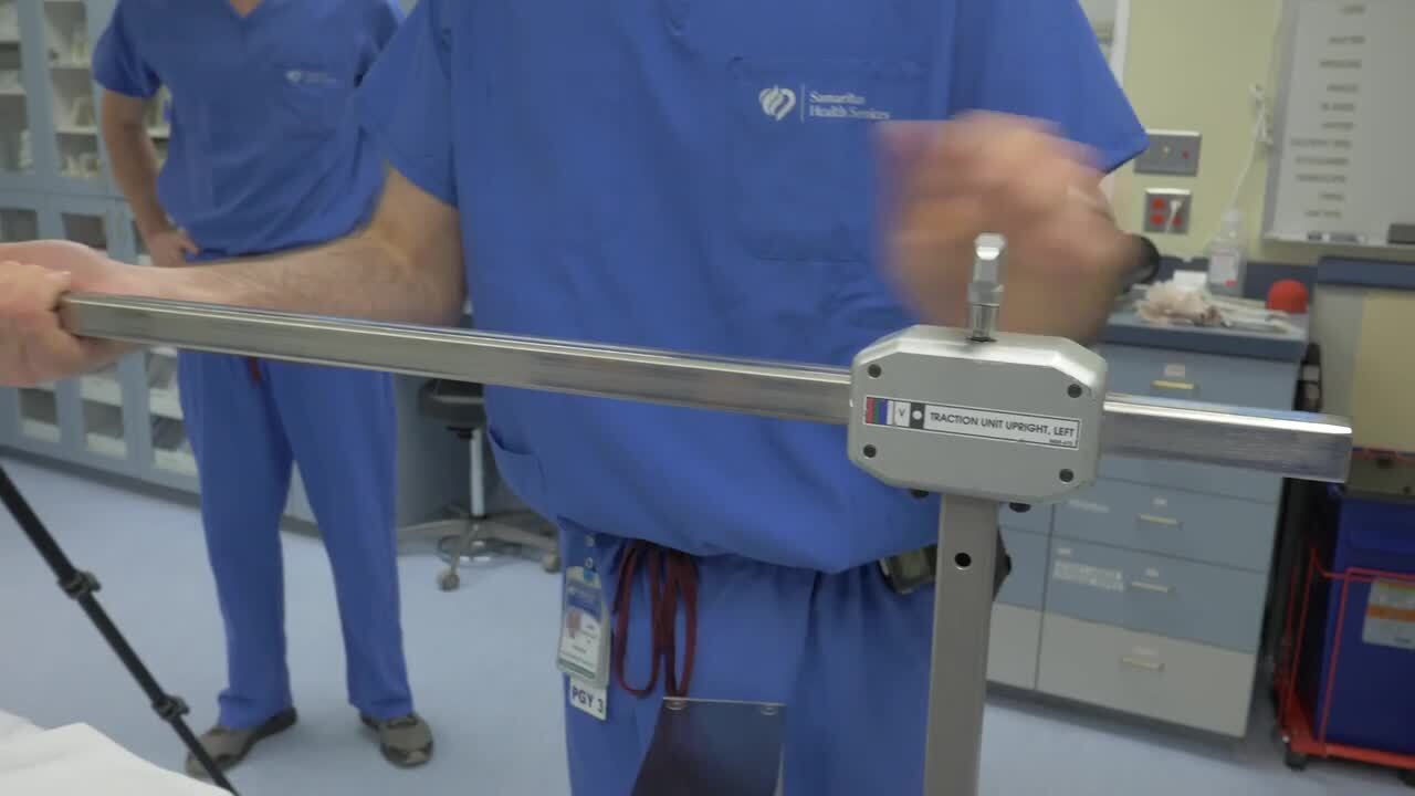 AAOS OVT Fracture Table SetUp