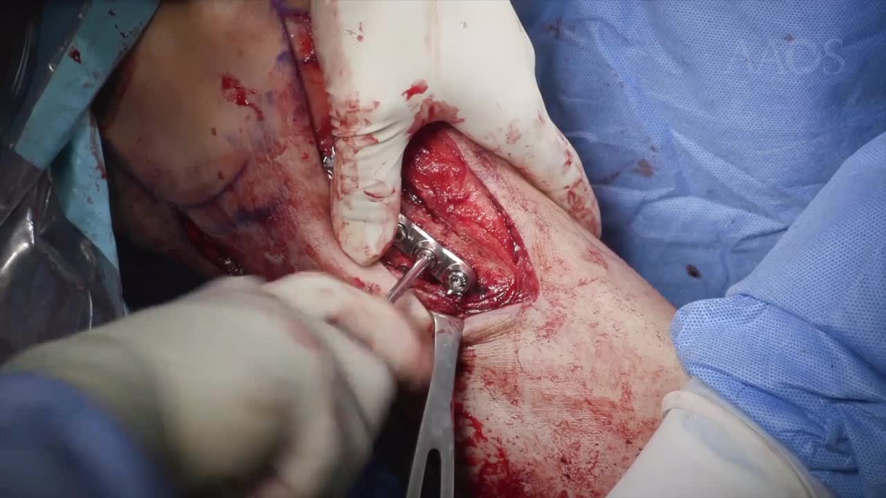 Video Details