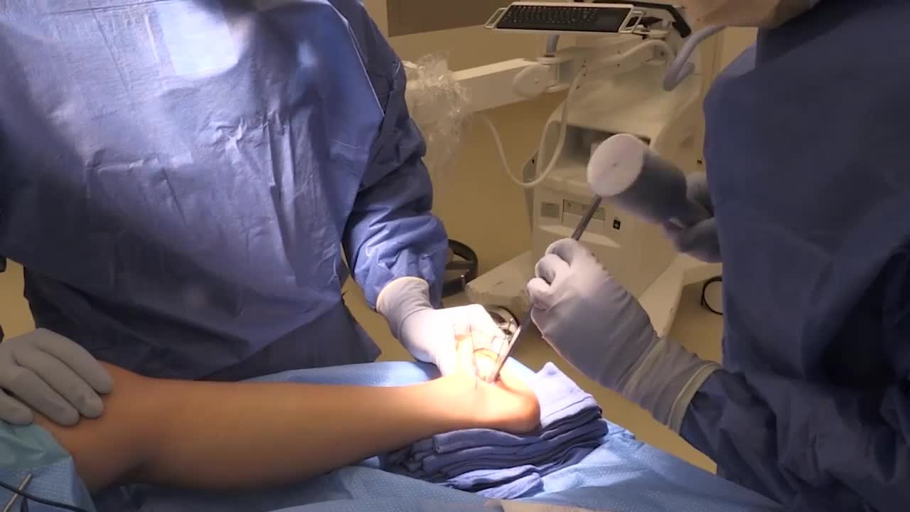 Sacrectomy Video Video Details