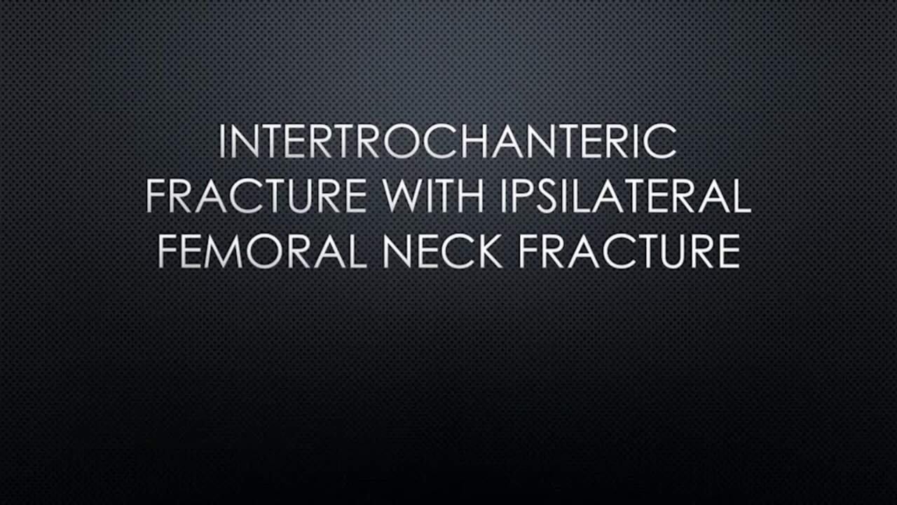 Total Hip Arthroplasty for Acute Intertrochanteric Fractures