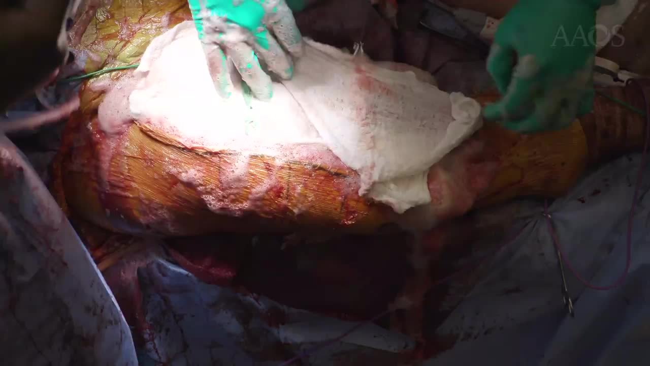 Video Details