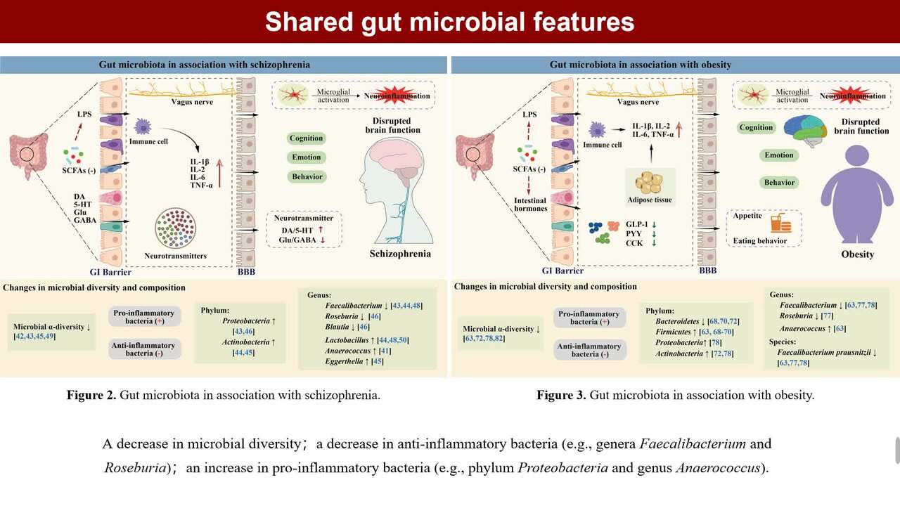 Schizophrenia and obesity: May the gut microbiota serve as a link for the  pathogenesis? - Wu - 2023 - iMeta - Wiley Online Library