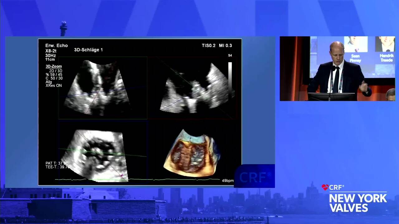 Case-in-Box - Cardiovalve