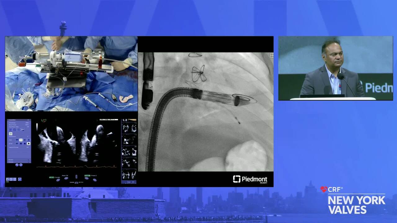 Case In A Box: TMVR in MAC: Piedmont