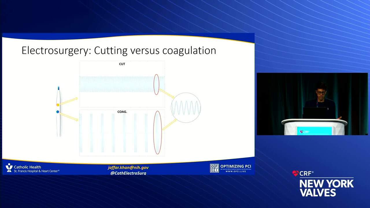 Principles of Transcatheter Electrosurgery