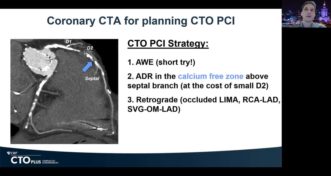 PENDING - CT-Guided ADR in a Calcium-Free LAD CTO Segment in a Post-TAVI/Post-CABG Patient