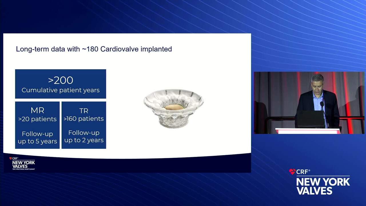 Cardiovalve TTVR: Technology and Clinical Program Update