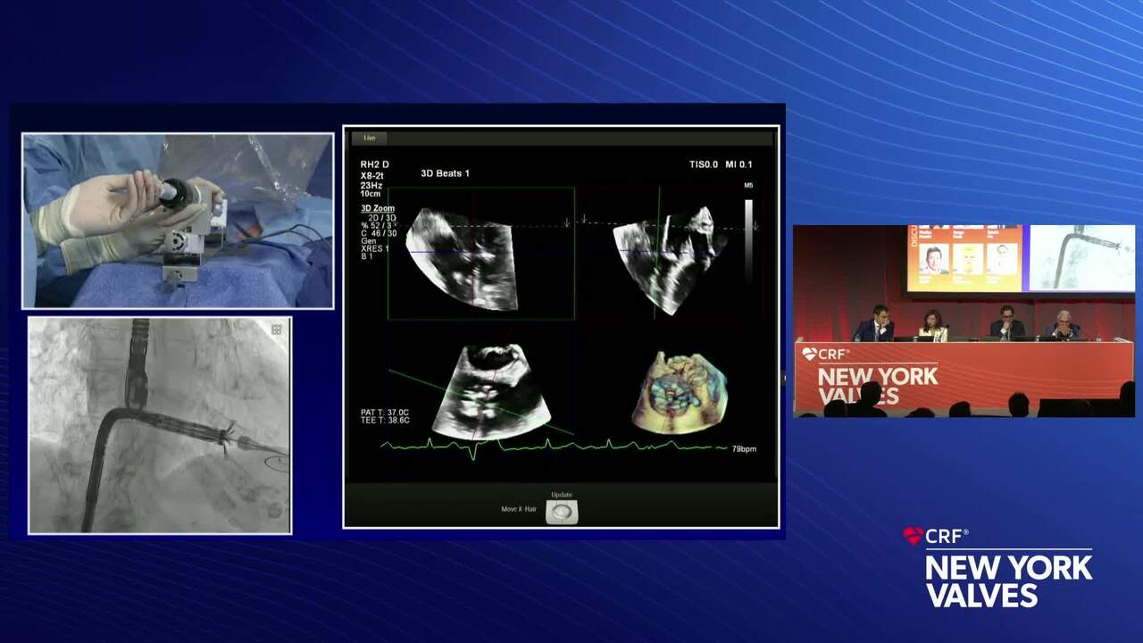 LIVE Case Presentation: New York Presbyterian - Columbia University, New York, NY