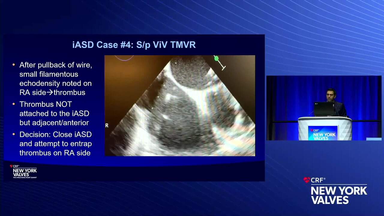 Vascular Access & Closure: Tips, Tools, and Iatrogenic ASD Management