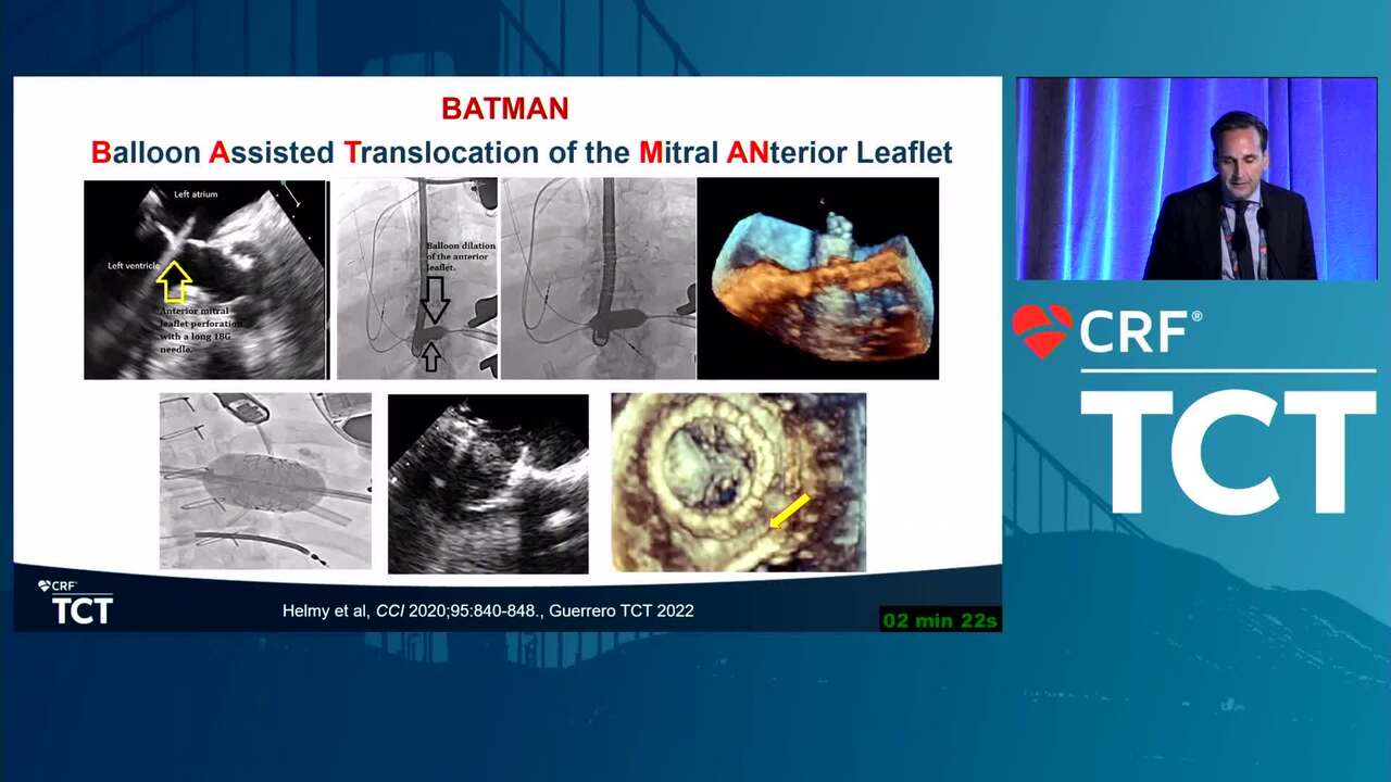 TMVR and Postprocedural Management Issues