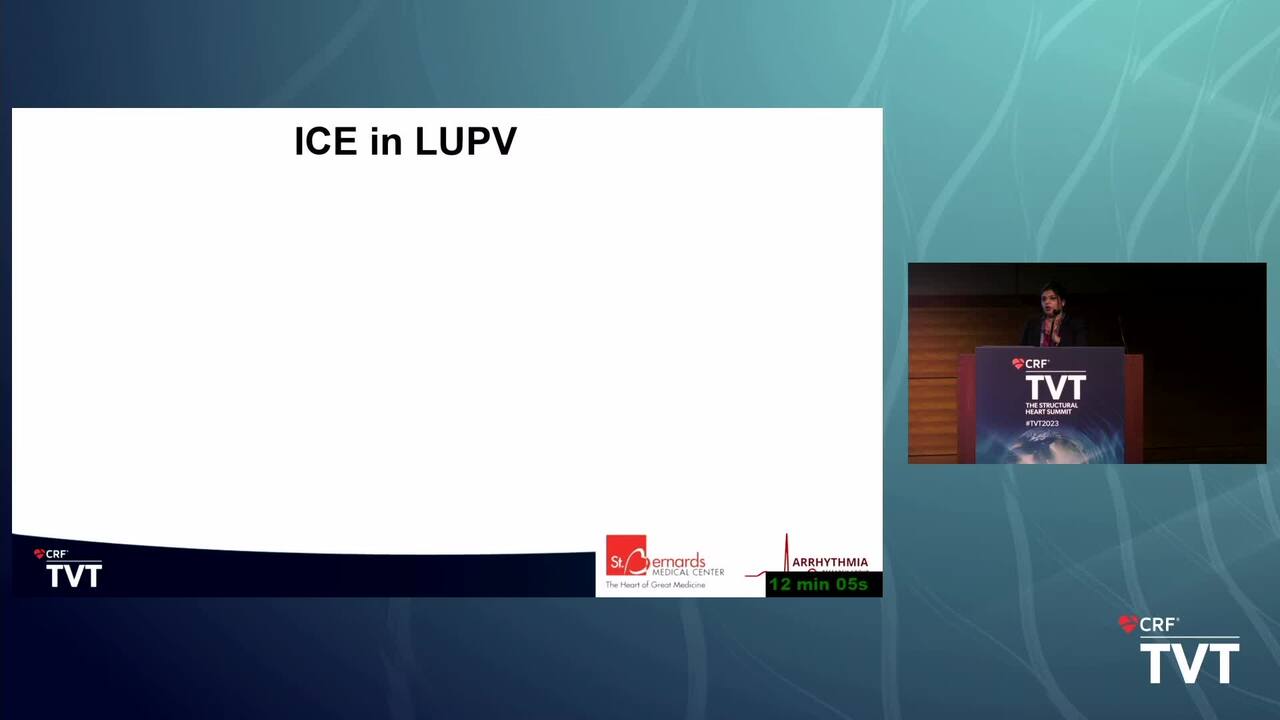 Optimal ICE Probe Positioning for LAAO