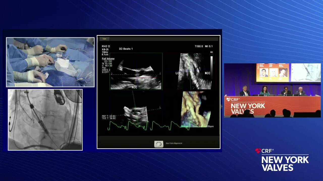 LIVE Case Presentation: New York Presbyterian Hospital - Columbia University, New York, NY