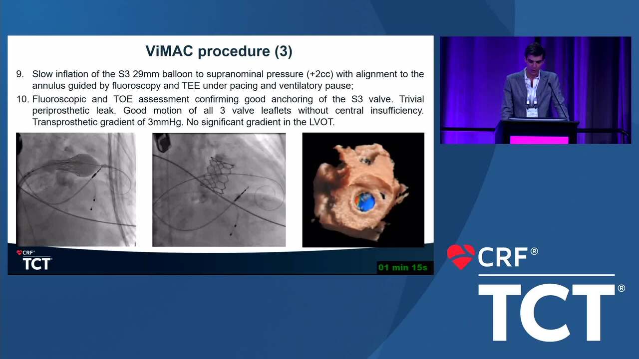 TCT 1590 Customized Cardiac Care Percutaneous ValveinMAC After