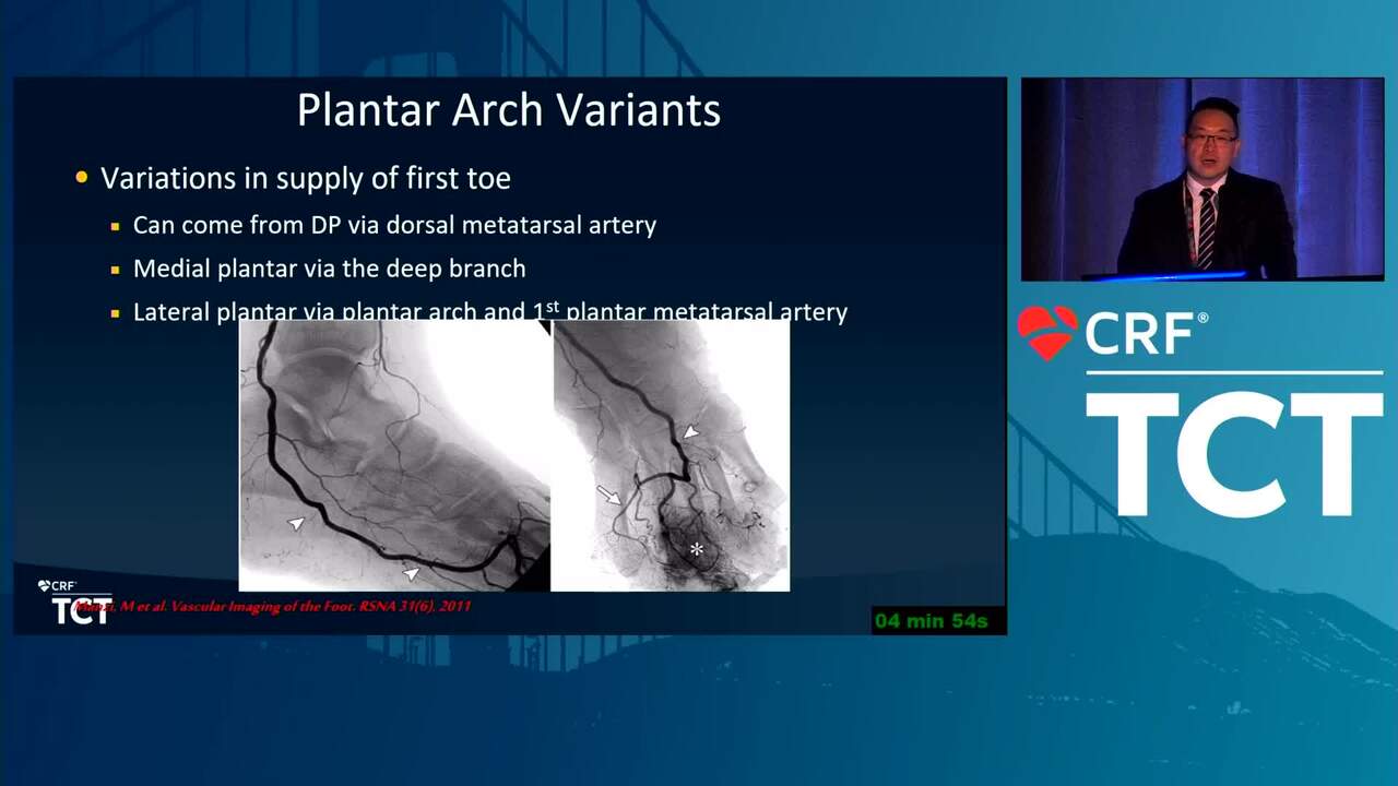 Critical Assessment of the Tibial Arch Anatomy