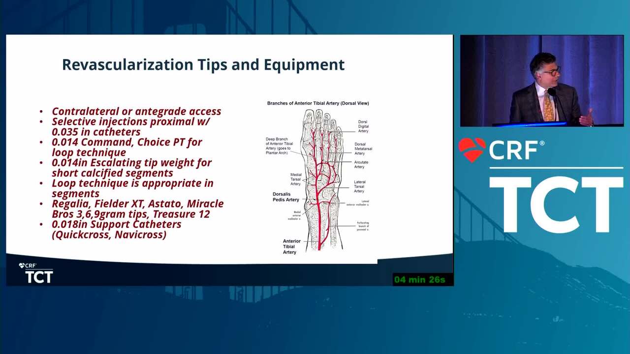 Complex Tibial Loop Reconstruction: A Step-by-step Guide to Success BTK and Below the Ankle