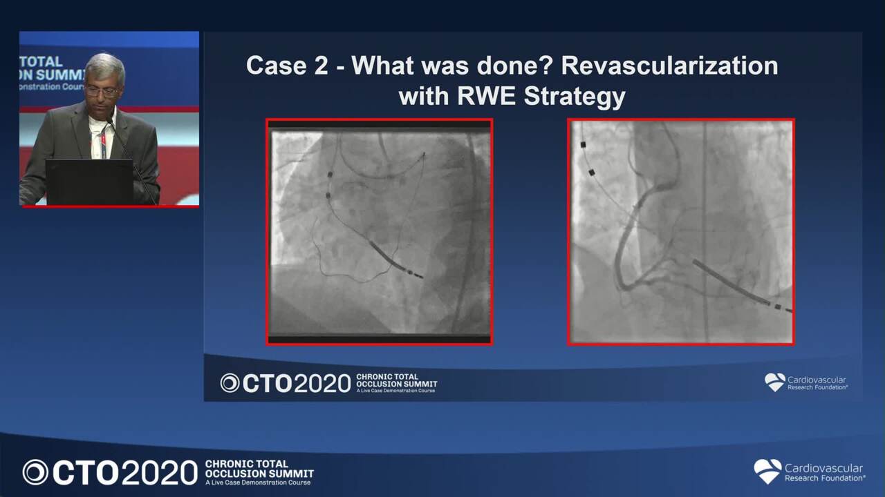 Case Selection for CTO PCI: Case Examples