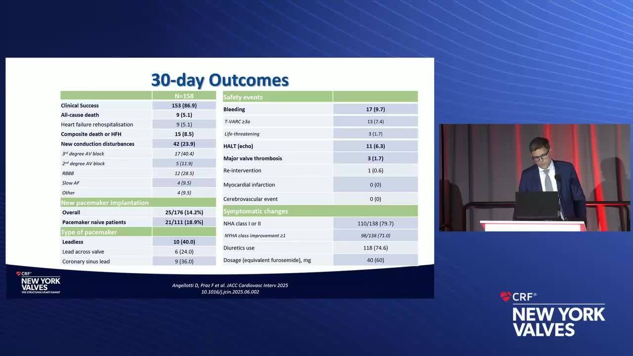 Early Outcomes of Real-World TTVR (Evoque)