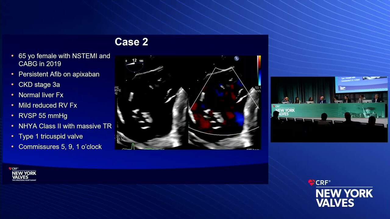 Anatomic Selection for Tricuspid TEER: Thumbs Up and Thumbs Down!