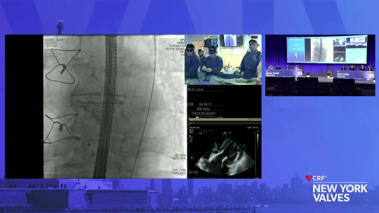 LIVE Case: Failed Surgical PERCIVAL  - St. Paul's Hospital, Vancouver, Canada