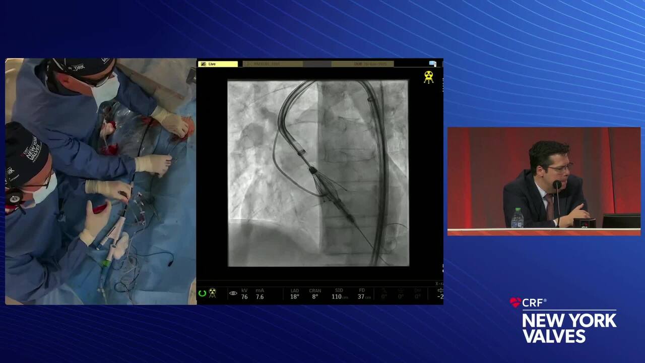 LIVE Case Presentation 1: Leeds General Infirmary, Leeds, UK