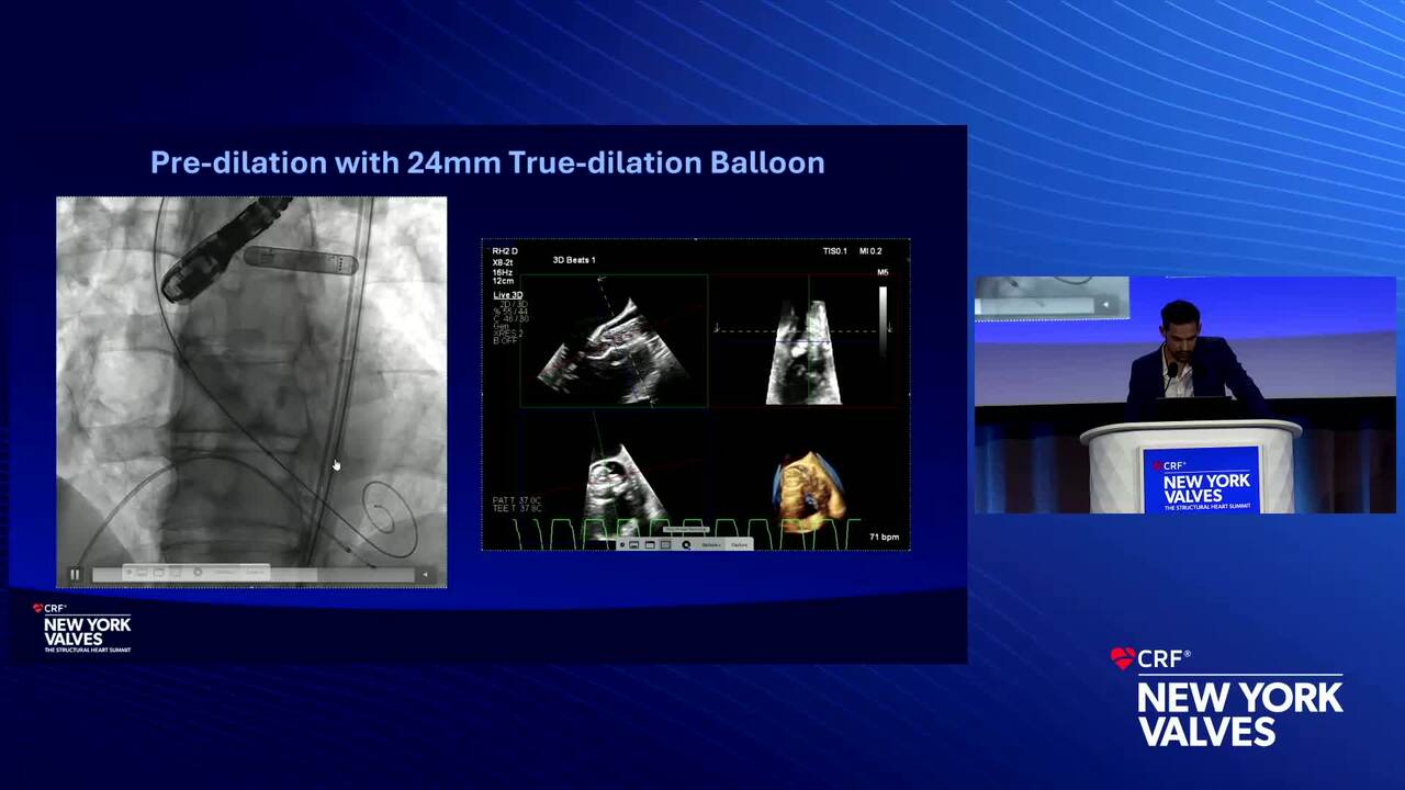 Case Resolution: A Young Low-Risk Patient With Symptomatic Severe Tri-Leaflet Aortic Stenosis