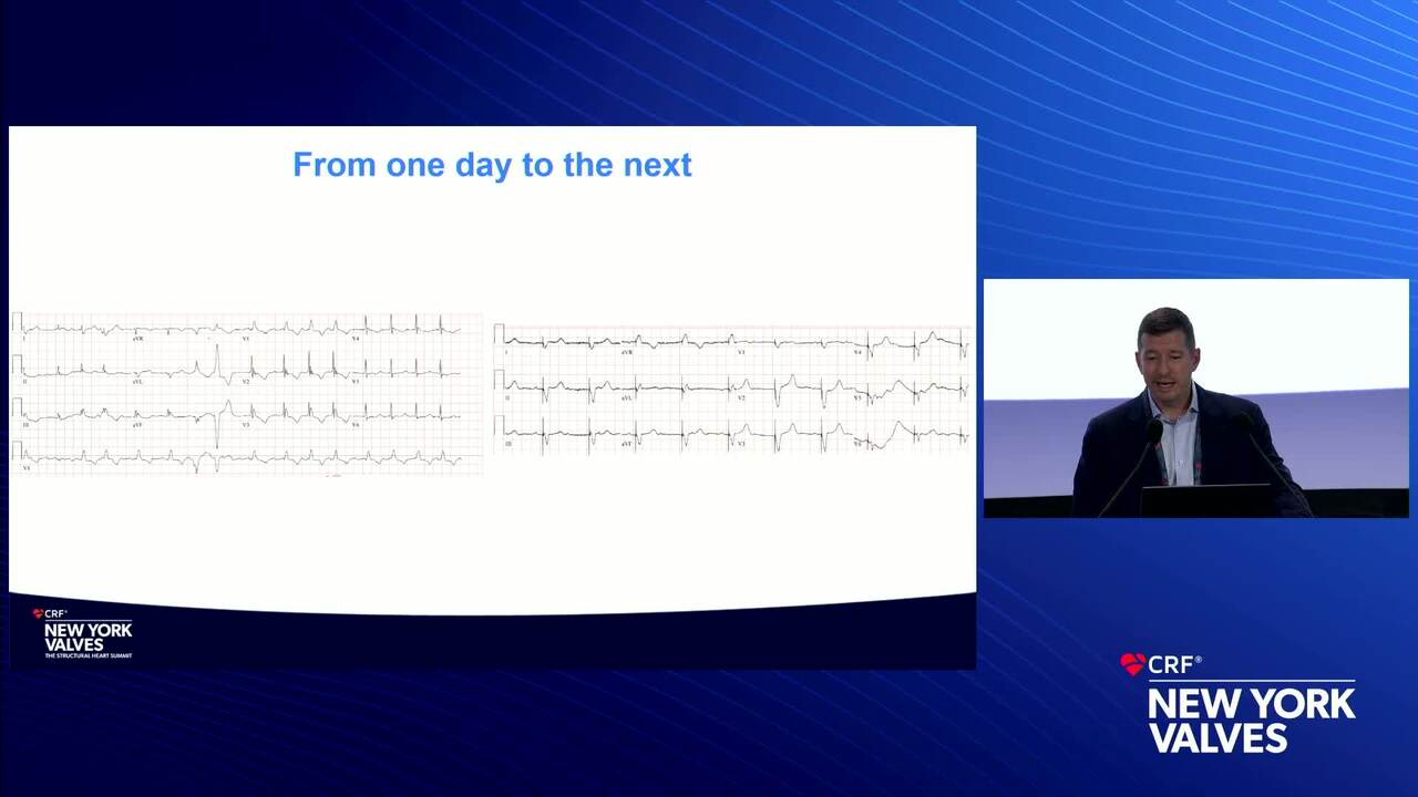 Is There a Rebound Favoring Surgery for Severe TR… Or Is RHF Still an Exclusion